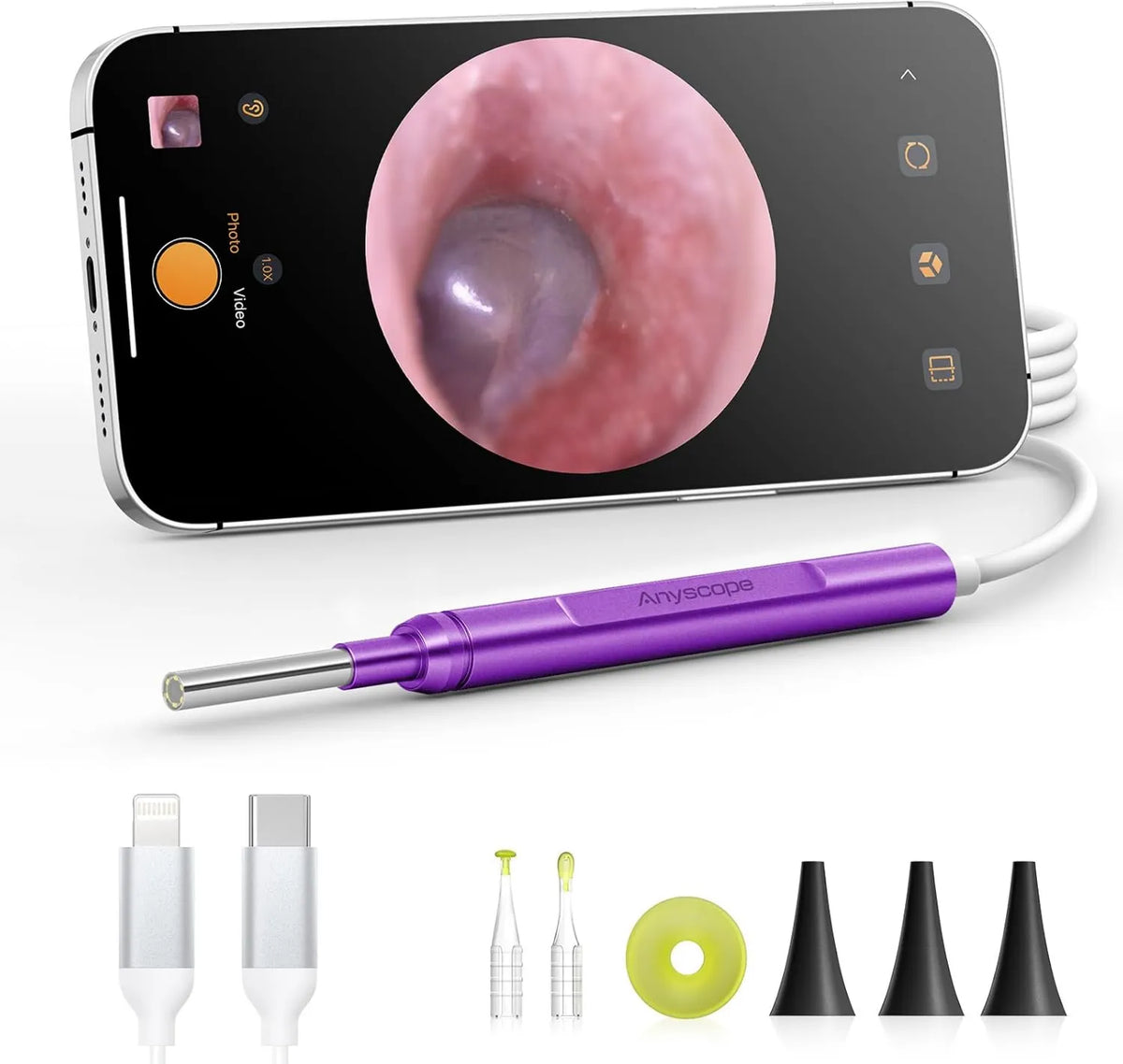 AnyScope, aparat fotograficzny, Android OS, urządzenia cyfrowe, otoskop kompatybilny z urządzeniami iPhone i Android